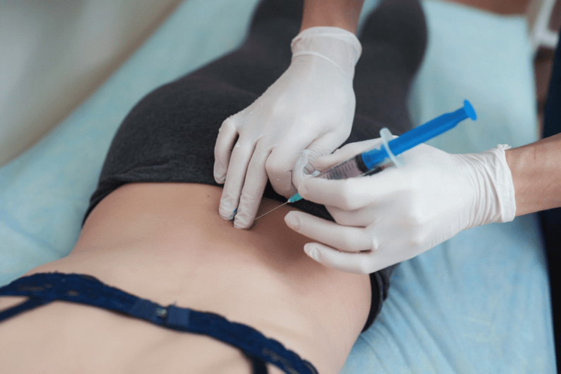 phong tỏa trong hoại tử xương thắt lưng